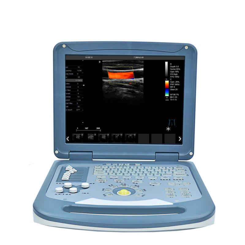 LCD Screen Ultrasound Scanner