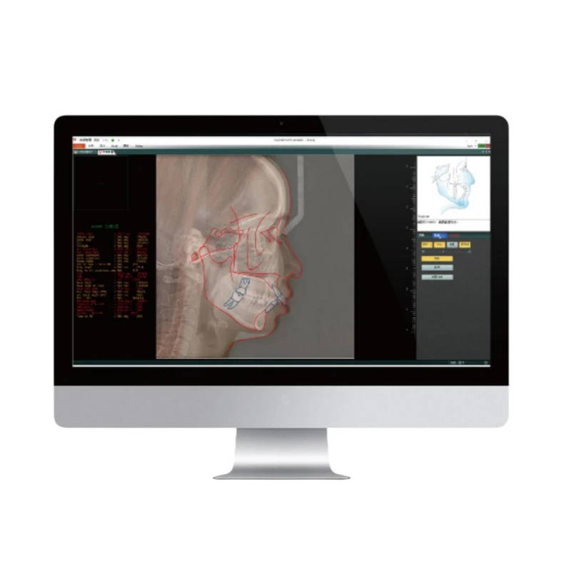 Cbct Imaging high quality