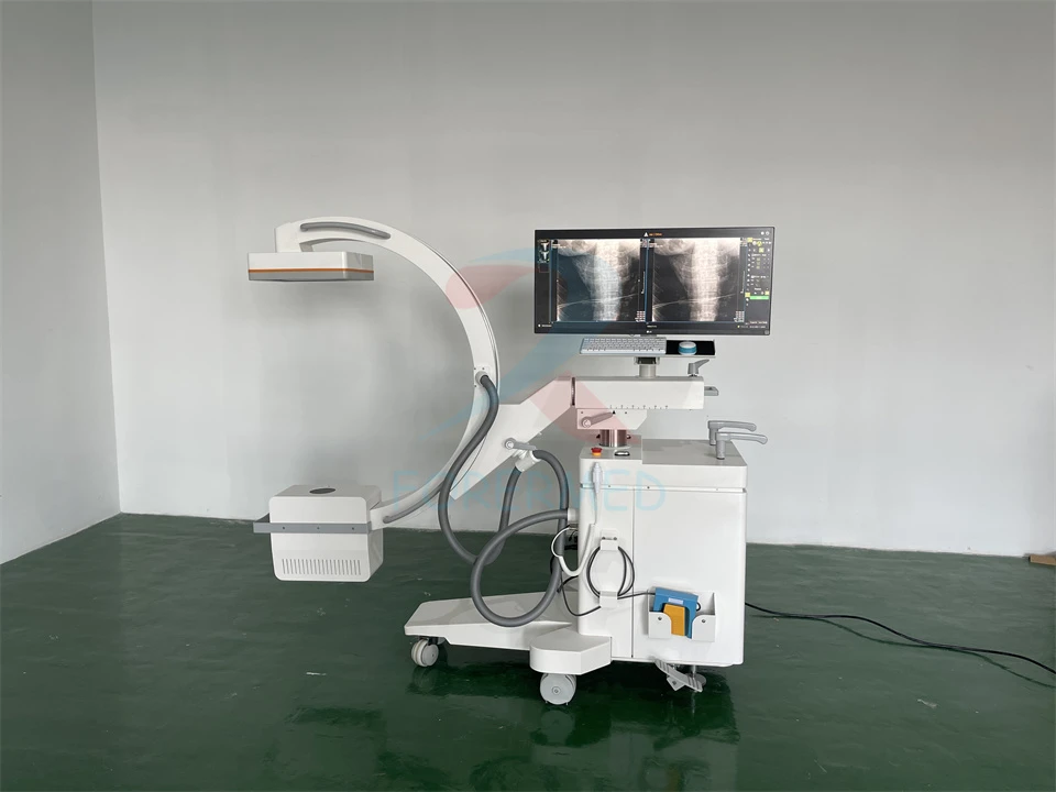 Mobile C arm X ray Machine