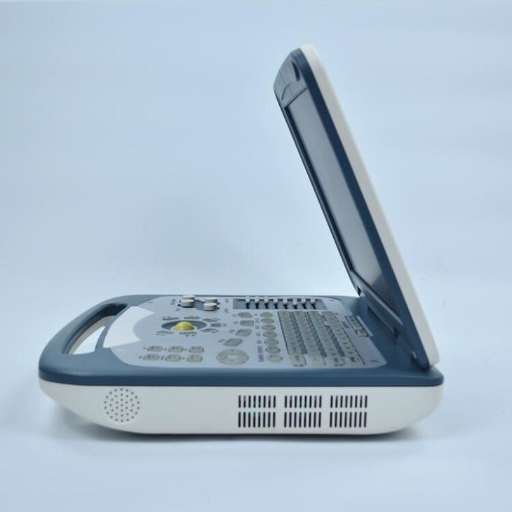 Computer Pregnancy Ultrasound Scanner