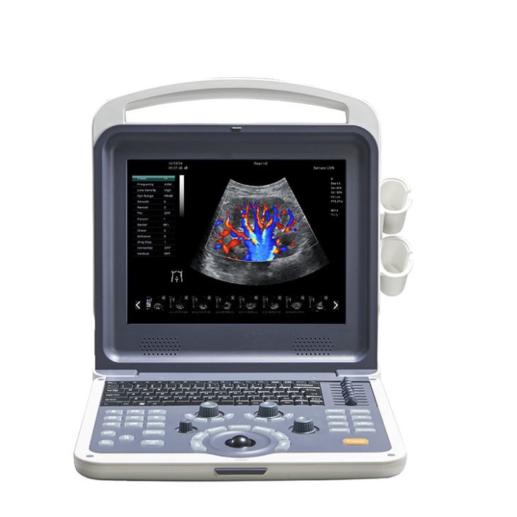 Ultrasound Probe Ultrasound Transducer Ultrasound Probe Ultrasound Transducer