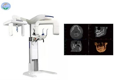 Дентална конусолъчева компютърна томография (CBCT